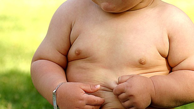 Genetic predisposition ... scientists have isolated an obesity gene.