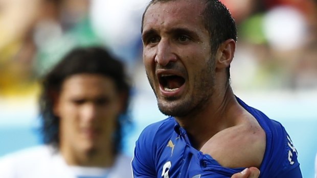 Bite marks: Italy's Giorgio Chiellini shows where he was bitten by Uruguay's Luis Suarez.