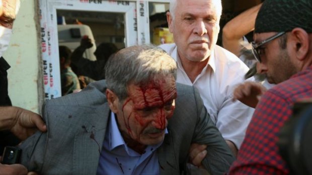 People help a man, who was hit with a stone thrown by demonstrators, during clashes between Kurdish demonstrators and riot police in Suruc, Turkey.