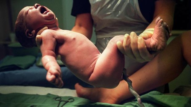 In Australia and Victoria, authorities lack reliable information about umbilical cords and links between 'true knots', or the cord being wrapped around a baby's neck, and its chance at life.