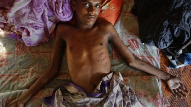Award-winning coverage: Akram, an 18-year-old Rohingya, who cannot walk, rests on a makeshift bed at a mosque near Songkhla, close to Thailand's border with Malaysia.