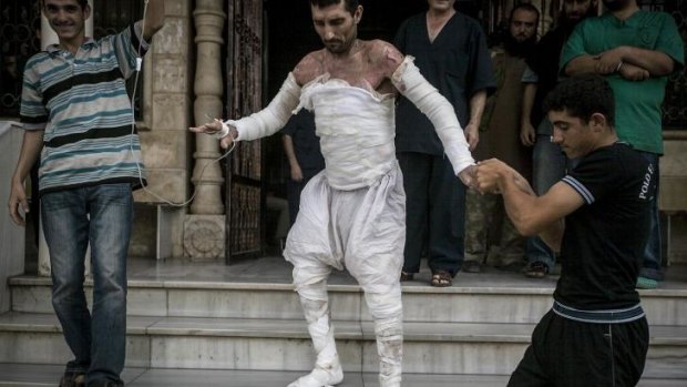 A Syrian burnt in an air strike in northern Idlib province leaves hospital.