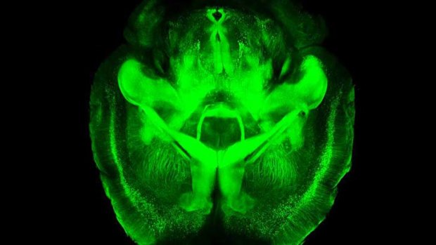 A CLARITY scan of an entire intact mouse brain.