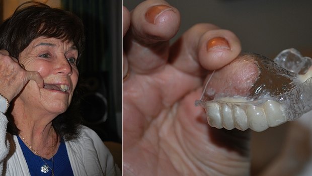 Doreen Wilkes shows her missing teeth and the temporary denture she claims was impossible to eat with.