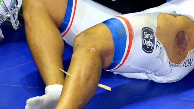 Azizulhasni Awang of Malaysia is treated by a medic after crashing and suffering a leg wound.