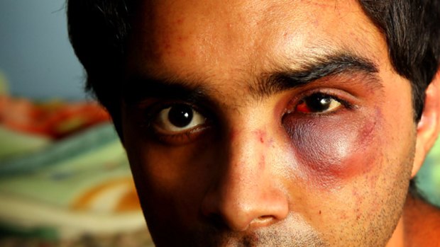 Indian student Sourabh Sharma was bashed and robbed by a racist gang on a train to Werribee.