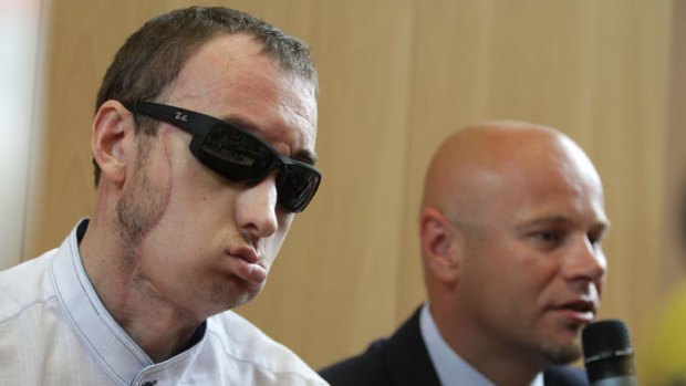 A man with a face transplant (left) and Professor Adama Maciejewskiego, head of the operation team, are pictured during a press conference in Poland.