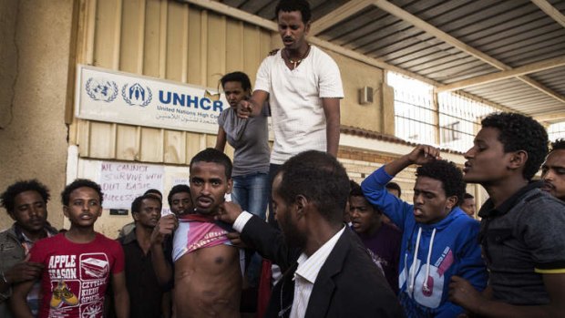 Marked man … an Eritrean refugee in Cairo displays the wounds he received while being held captive.