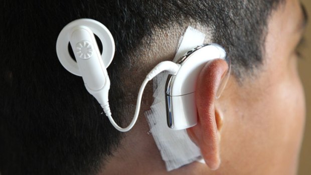 A recipient of Cochlear's bionic ear.