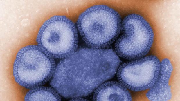 Deadly ... the H1N1 strain of the swine flu virus.