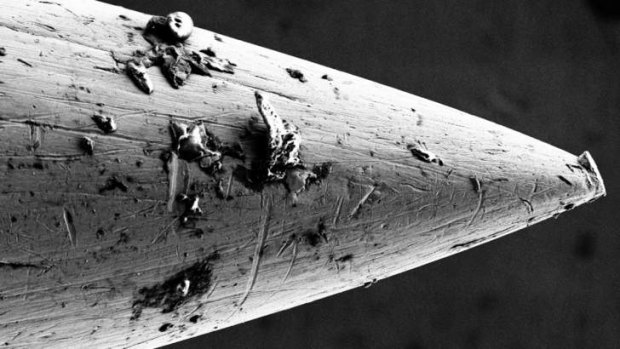 A microscopic image of one of the acupuncture needles.