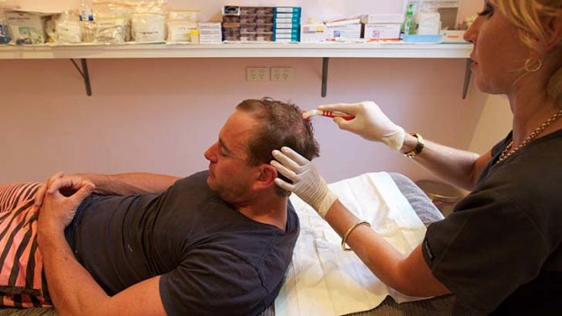 Cover-up ... Nathan Lowe, 36, has treatment for thinning hair.