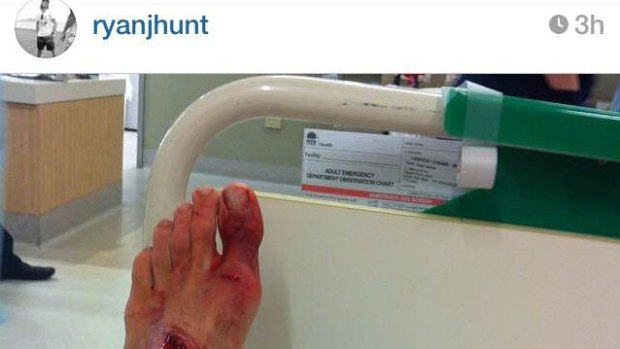 The gash on Ryan Hunt's foot after he was bitten by a shark. 