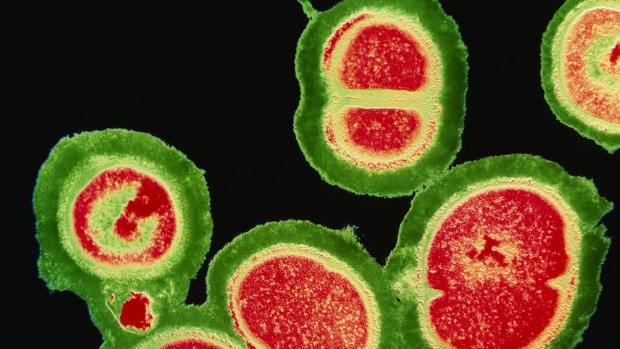 A deadly cluster of resistant staphylococcus bacteria.