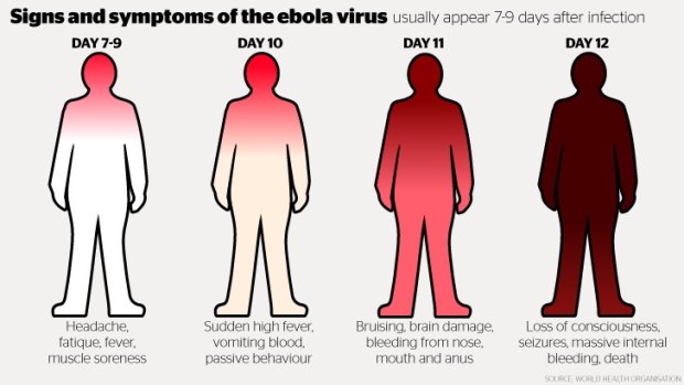 Signs and symptoms of Ebola