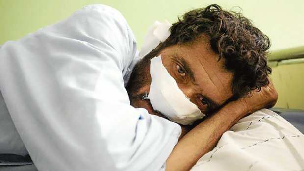 Lal Mohammad, 40, whose nose and ears were cut off by the Taliban.