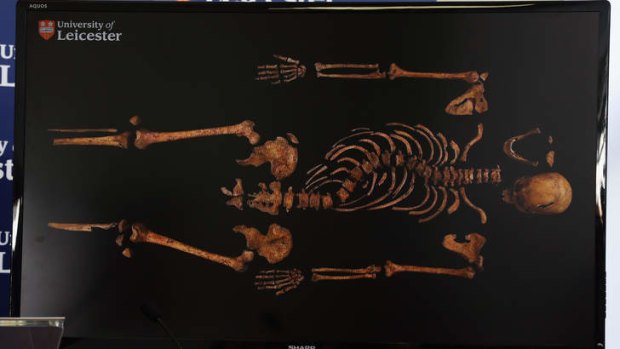 Burial wrangle ... the skeletal remains confirmed as those of Richard III this month.