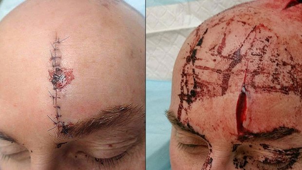 Gruesome images of the senior constable's injuries were released by WAPU on Thursday afternoon. 