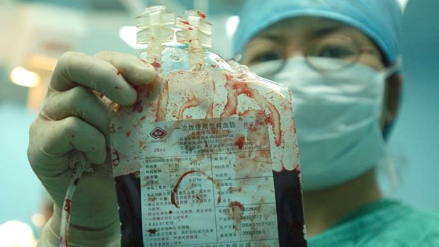 A Beijing Chuiyangliu Hospital doctor displays umbilical cord blood collected from a newborn baby.