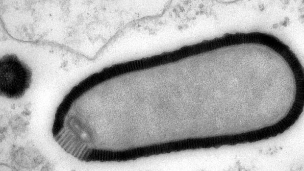 A magnified image of a pithovirus particle in an infected amoebae.