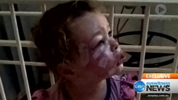 Two-year-old Ariana is recovering in hospital following the attack