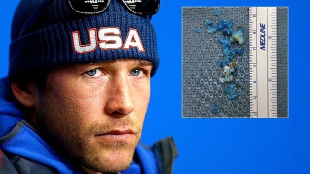 Veteran Olympic skier Bode Miller and 'crabmeat' (inset) that was pulled from his back.