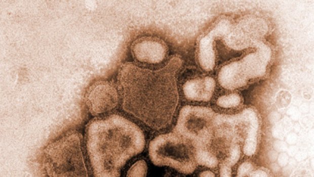 Swine flu ... this colorised image from a transmission electron micrograph (TEM) depicts the A H1N1 virus from a previous outbreak in 1976.