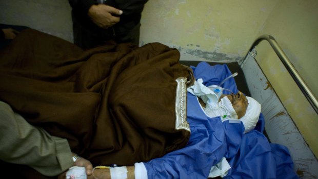 Sheikh Sulieman Ghanem, 75, receives medical treatment at Suez Canal University hospital in Ismailia, Egypt.