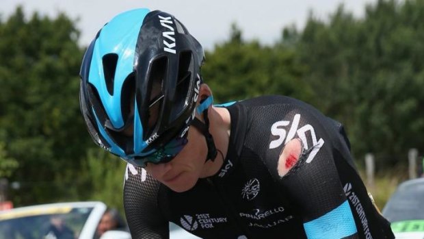Sky is falling: Chris Froome bears the scars.