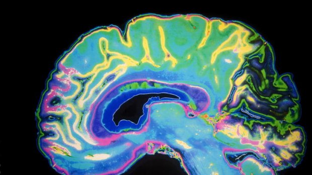 Almost a third of dementia diagnoses are incorrect, a medical expert says.