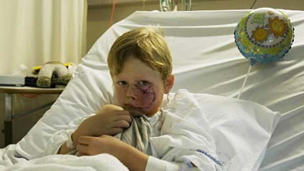 Attacked while sitting out the front of his house with friends... Daniel Breen, 6, at Liverpool Hospital.