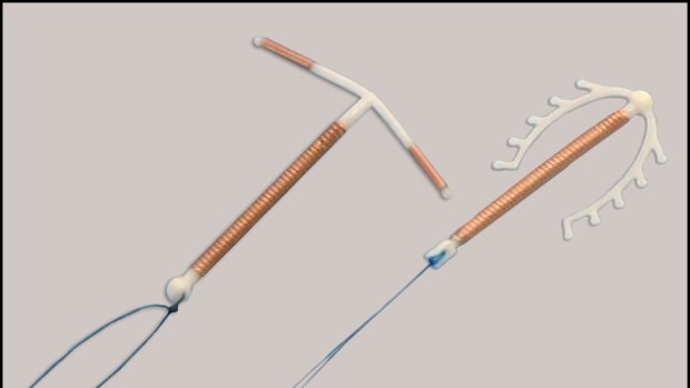 Copper intrauterine devices.
