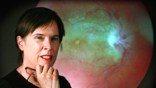 Professor Judy Savige heads a research team at Northern Hospital that is examining retinas for signs of vascular disease.