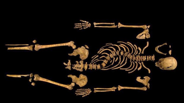 King Richard III of England:The Phenice method could be used to determine the unknown sex of a skeleton.