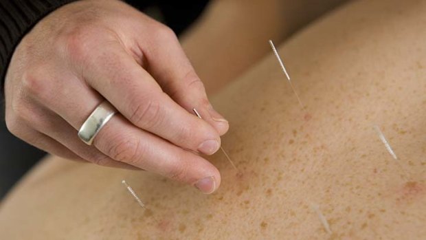 The populatiry of alternative medicine, such as acupuncture, has some scientists worried.