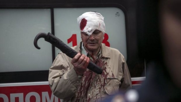 An injured man stands near an ambulance during clashes between pro-Russian and pro-Ukrainian supporters at a rally in Donetsk, eastern Ukraine.