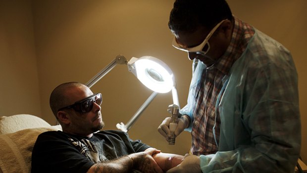 Safer option ... Dr Pramod Parmar uses a laser to remove a tattoo from Lee Parker.