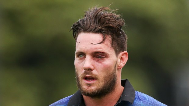 Lucky escape:  Mitchell McClenaghan leaves the field with an injured eye after being struck by a bouncer.