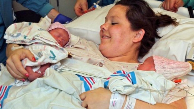 Sarah Thistlethwaite holds her twin daughters Jenna and Jillian shortly after their birth in Akron, Ohio.
