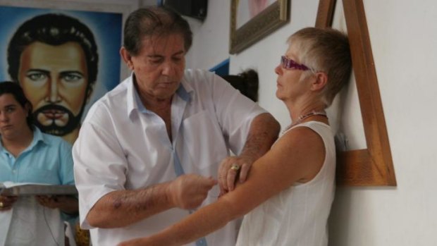 Joao de Deus operates on a woman's arm.