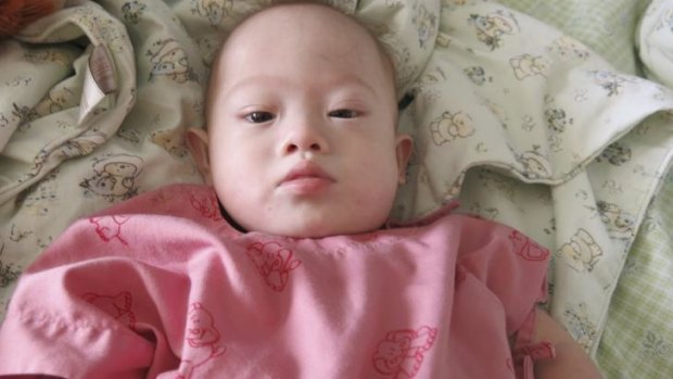 Baby Gammy in a Thai hospital on Sunday.