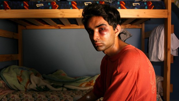 Fractured cheek ... a racist gang bashed and robbed 21-year-old Melbourne student Sourabh Sharma on a train.