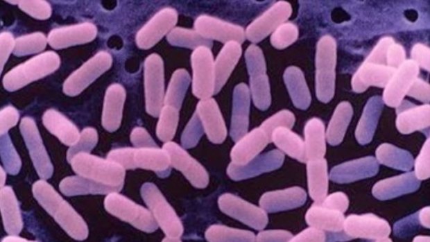 Listeria bacteria.