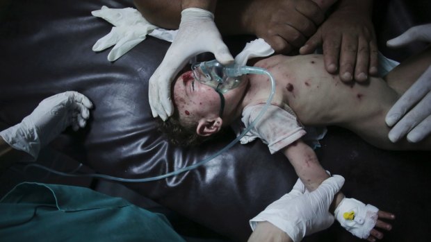 A wounded girl is treated at the emergency room of the Shifa hospital in Gaza City.