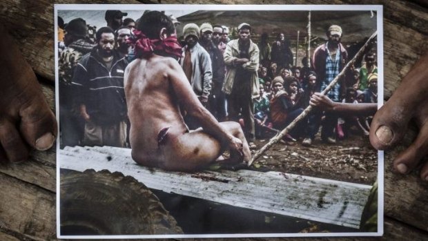 Torture: This woman was accused of sorcery and assaulted by people from her village.No one was charged with the attacks on her.