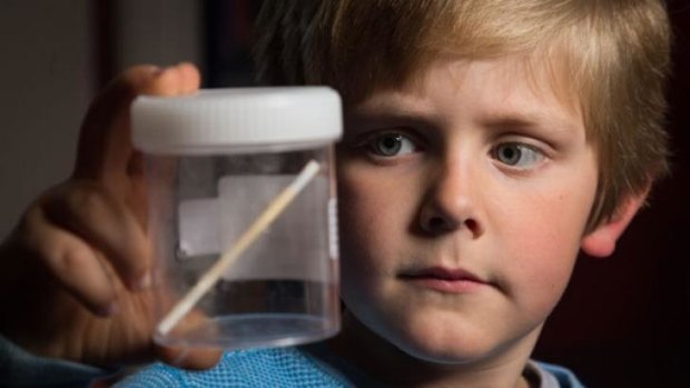 Gus Denton, 5, with the Chupa Chup stick that was lodged inside him for eight months.