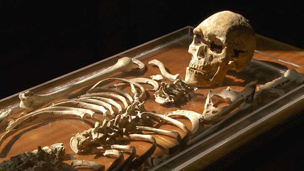 Fear of bad medicine: Narrabeen man's skeleton.
