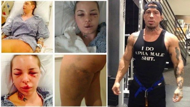 Assault victim Christy Mac (left) and mixed martial arts fighter War Machine (right).