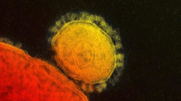 A colorised transmission of the MERS coronavirus.