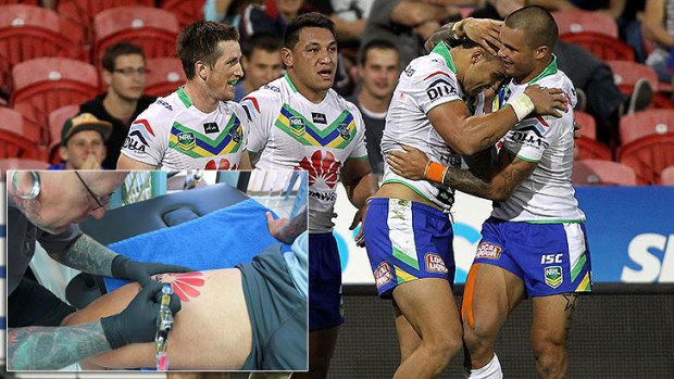Sandor Earl (far right) had a noticeably tattoo-free right thigh in Sunday's match.